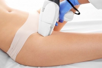 Epilazione a luce pulsata